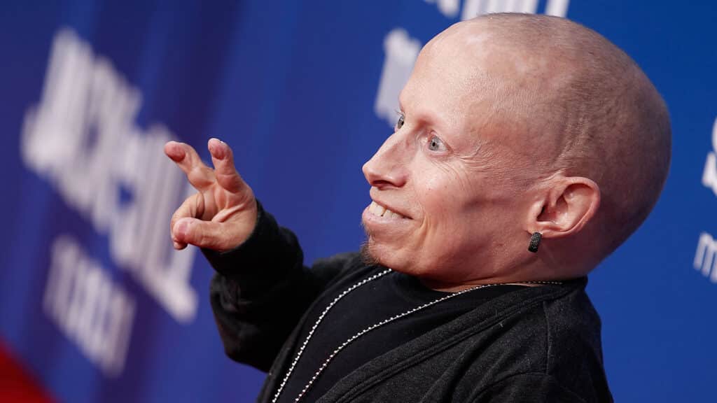 Mini-Me Austin Powers actor Verne Troyer dies aged 49 6 Mini-Me Austin Powers actor Verne Troyer dies aged 49 5